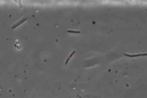 Image for Understanding Bacterial Swimming to Stop Infections in Catheters
